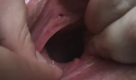 - واقعی عکسهای کونزن تبدیل